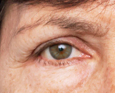 Ageing Skin